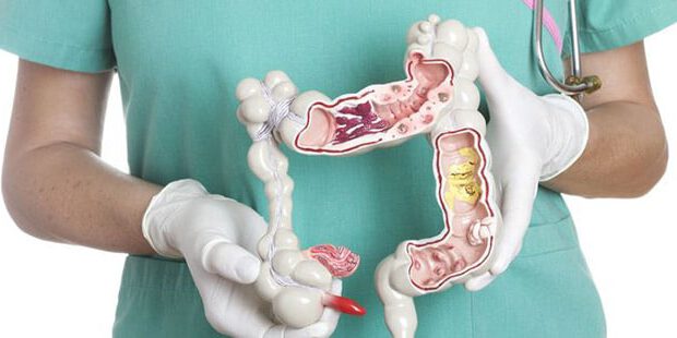 Гидроколонотерапия в санатории «Солнечная долина»