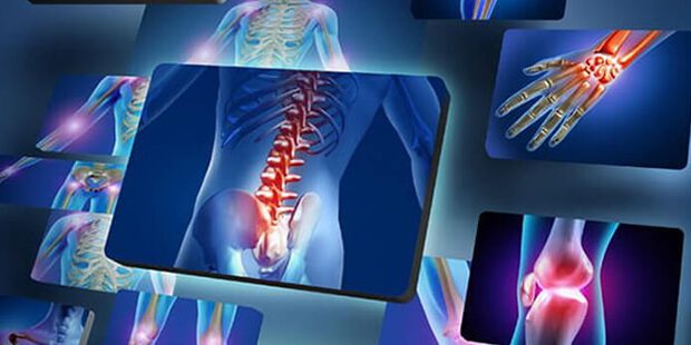 Лікування суглобів у санаторії «Поділля» у Хмільнику