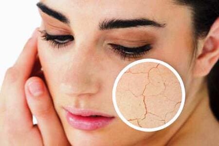 догляд за сухою шкірою