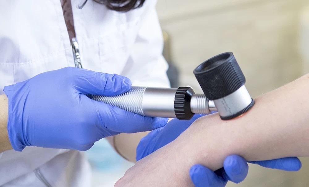 виды кожных заболеваний