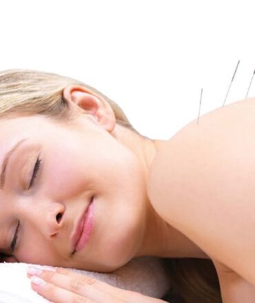 Что такое акупунктура: древний метод лечения в современном мире