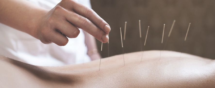 Акупунктура для схуднення